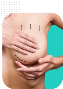 پروتز سینه