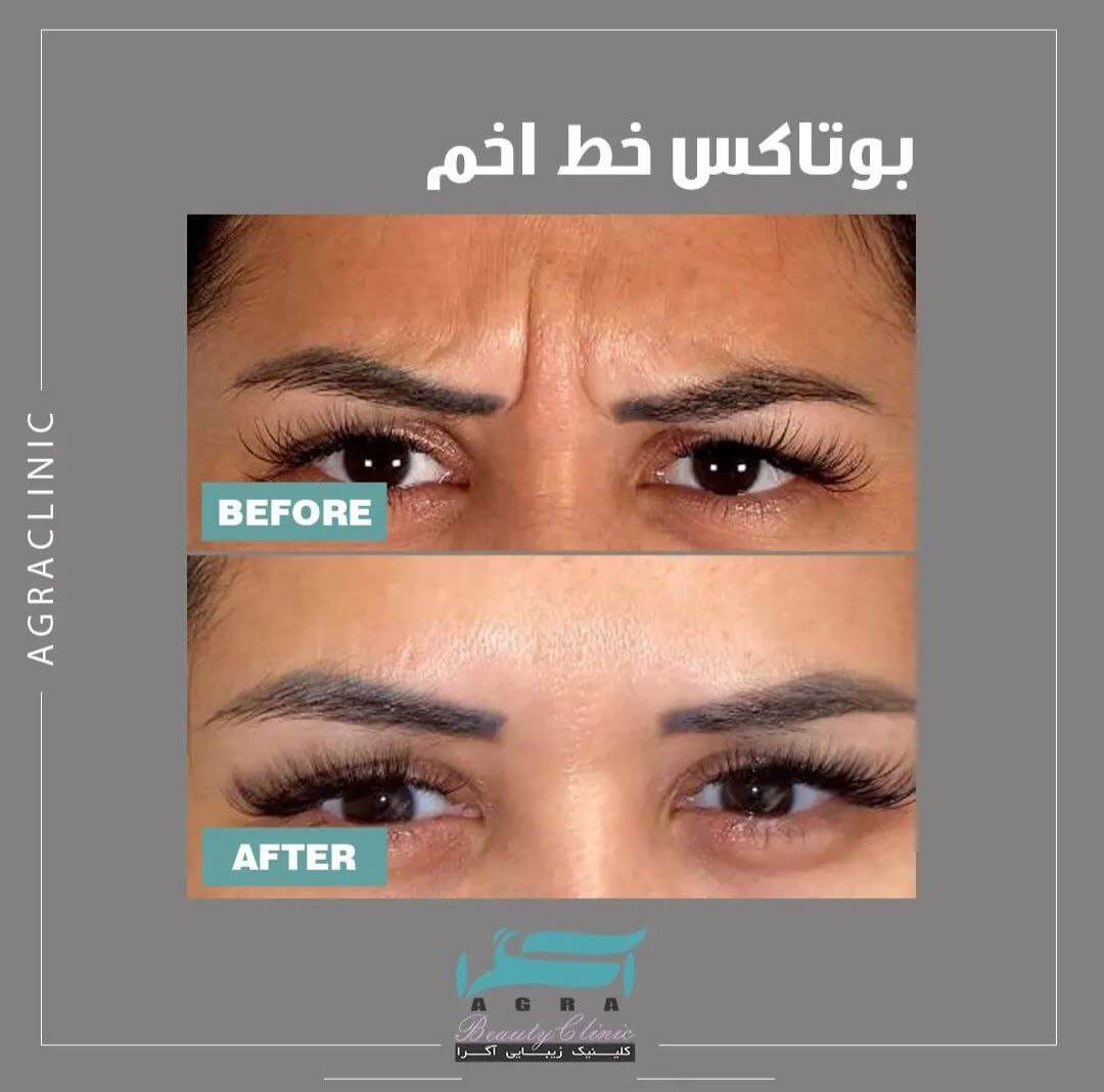 مرکز تزریق بوتاکس در رسالت
